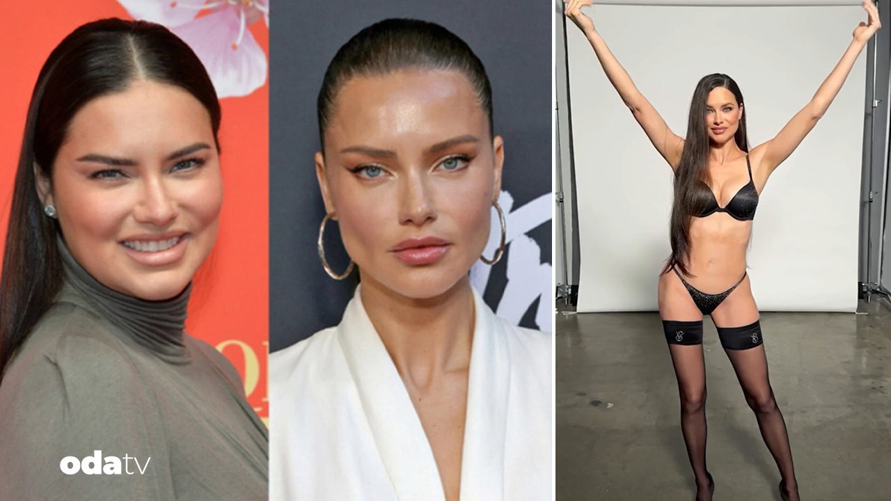 adriana limanin son hali yuz yaglarini mi aldirdi z8khI11T