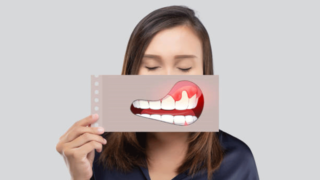 Diş apsesi için evde uygulanacak destekleyici yöntemler neler?